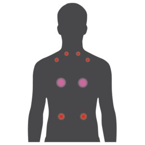 Massage Diagram for the Bullfrog Spas NeckEase Jetpak